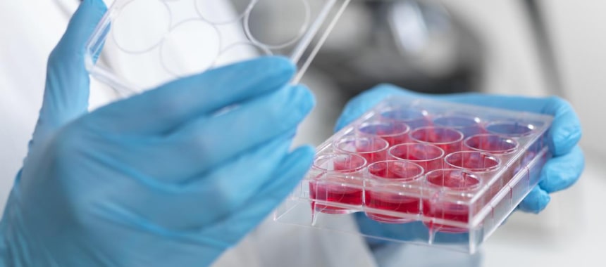 Лечение стволовыми клетками: клеточная терапия заболеваний Лечение стволовыми клетками: клеточная терапия заболеваний